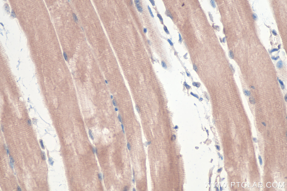 Immunohistochemical analysis of paraffin-embedded mouse skeletal muscle tissue slide using KHC0361 (MYO18B IHC Kit).