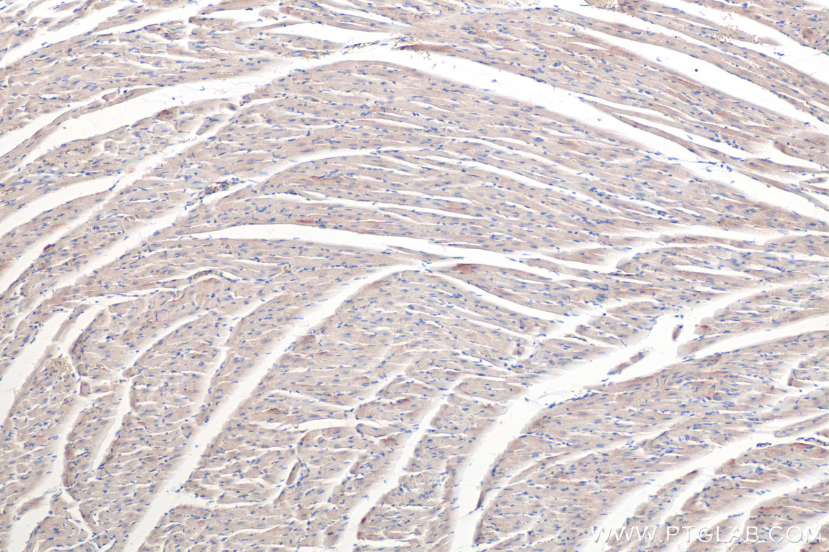 Immunohistochemical analysis of paraffin-embedded rat heart tissue slide using KHC0361 (MYO18B IHC Kit).