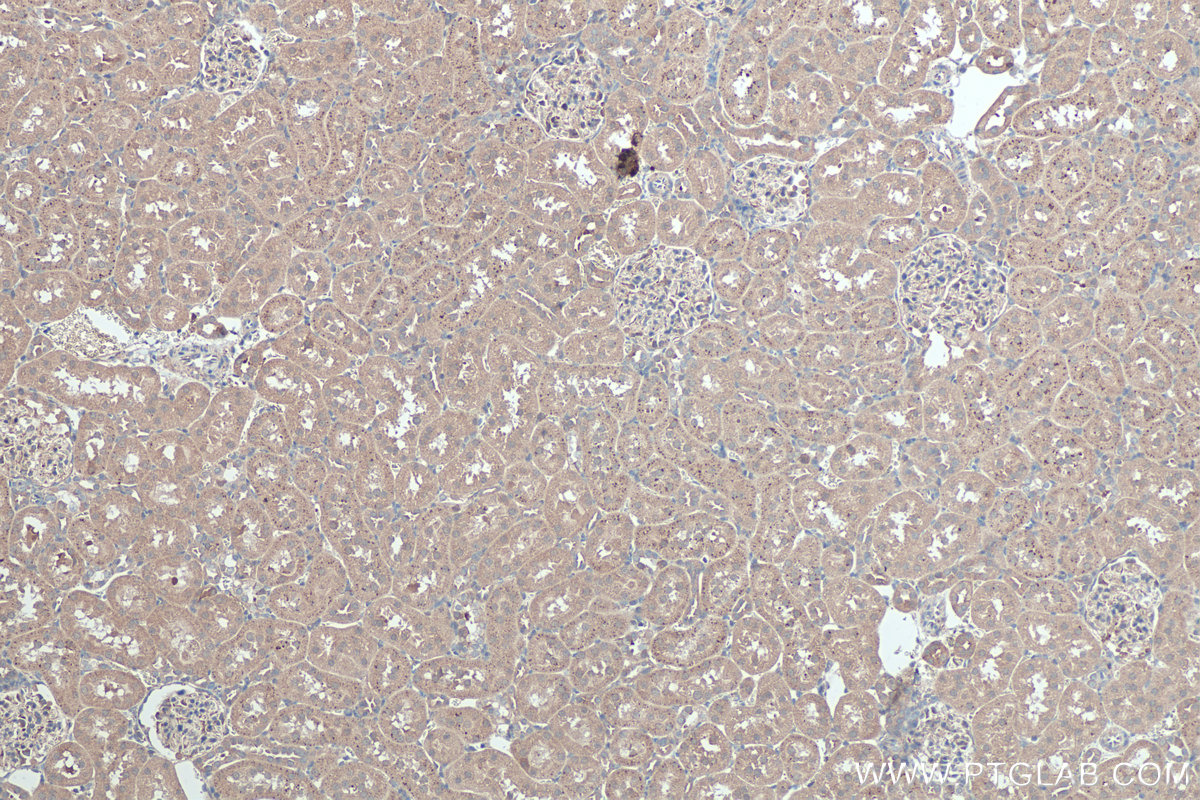 Immunohistochemical analysis of paraffin-embedded rat kidney tissue slide using KHC0362 (MYO19 IHC Kit).