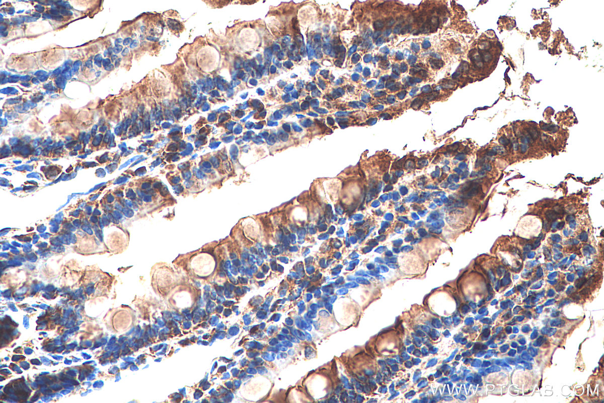Immunohistochemical analysis of paraffin-embedded rat small intestine tissue slide using KHC0366 (MYO1A IHC Kit).