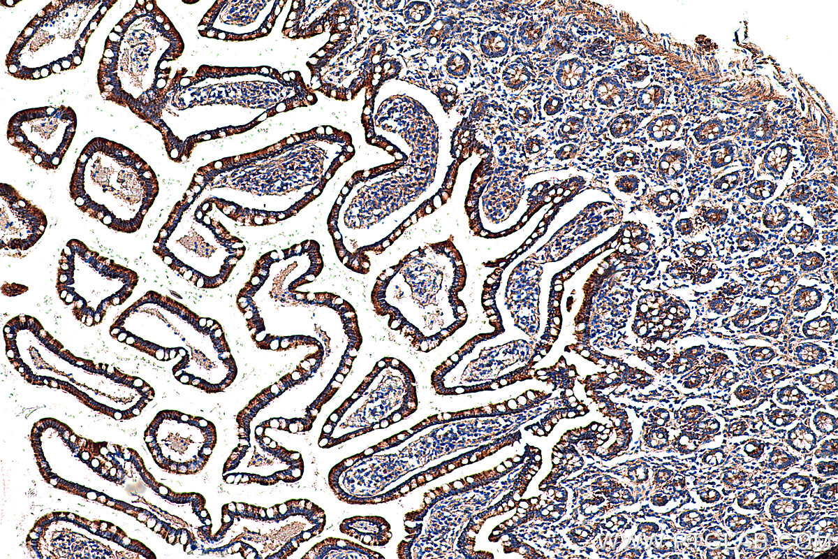 Immunohistochemical analysis of paraffin-embedded human small intestine tissue slide using KHC0366 (MYO1A IHC Kit).