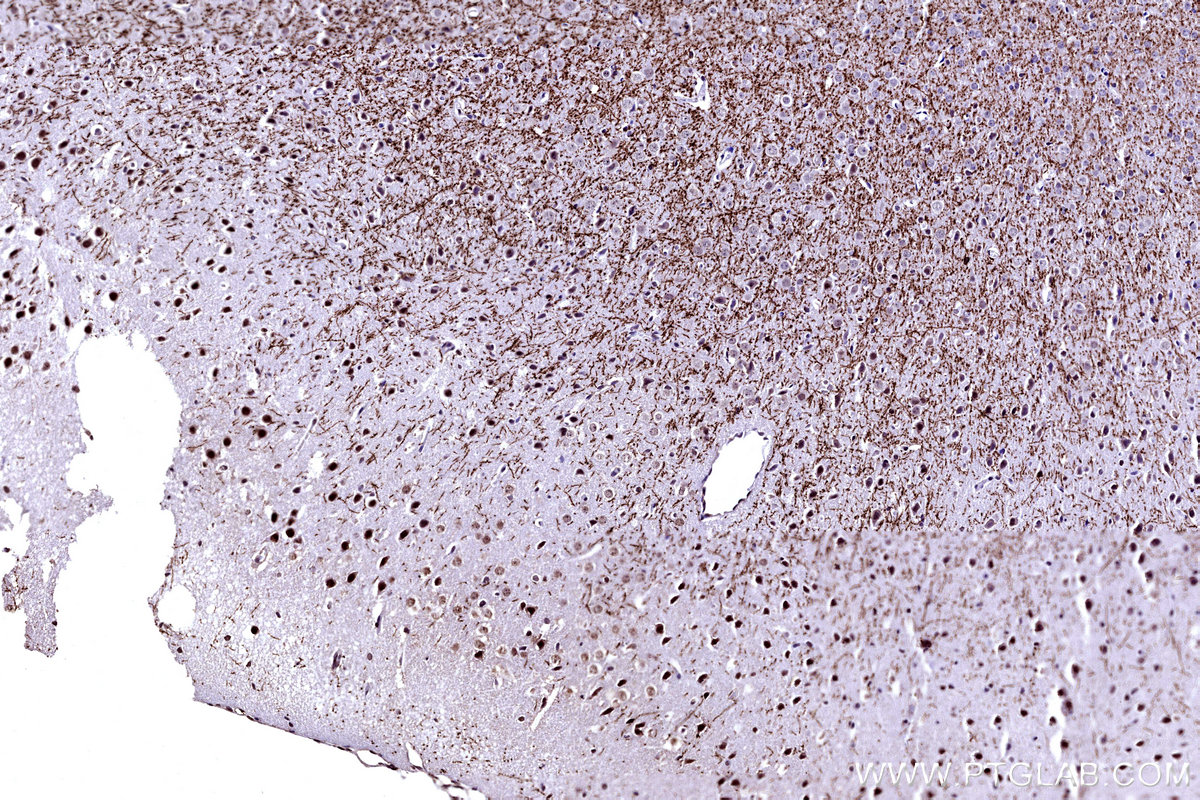 Immunohistochemical analysis of paraffin-embedded mouse brain tissue slide using KHC3152 (MYO1D IHC Kit).