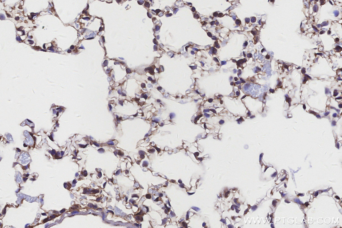 Immunohistochemical analysis of paraffin-embedded mouse lung tissue slide using KHC3152 (MYO1D IHC Kit).