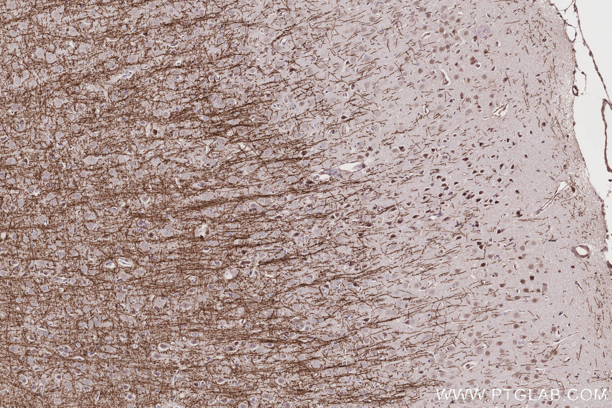 Immunohistochemical analysis of paraffin-embedded rat brain tissue slide using KHC3152 (MYO1D IHC Kit).