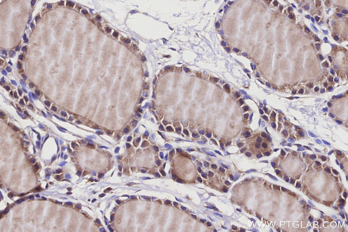 Immunohistochemical analysis of paraffin-embedded rat thyroid gland tissue slide using KHC3152 (MYO1D IHC Kit).