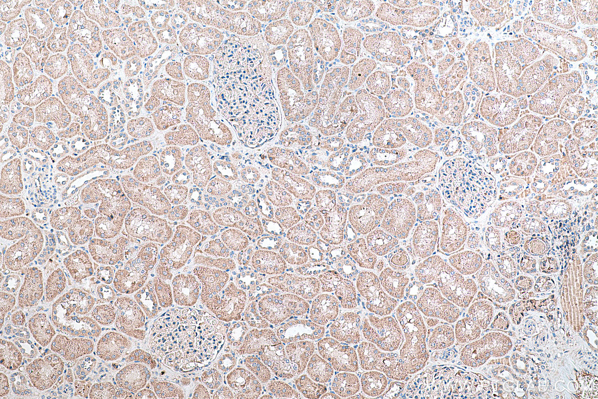 Immunohistochemical analysis of paraffin-embedded human kidney tissue slide using KHC0354 (MYO1E IHC Kit).