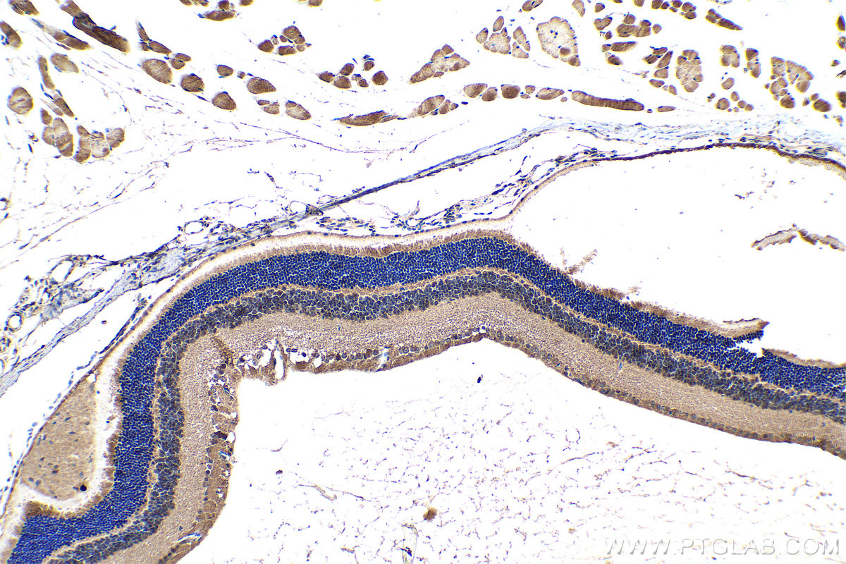 Immunohistochemical analysis of paraffin-embedded mouse eye tissue slide using KHC0355 (MYO3A IHC Kit).