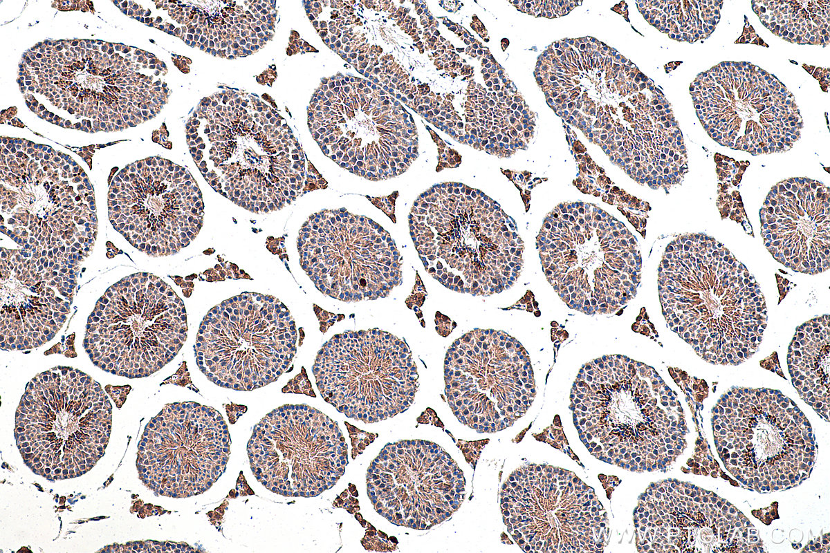 Immunohistochemical analysis of paraffin-embedded mouse testis tissue slide using KHC0358 (MYO7A IHC Kit).