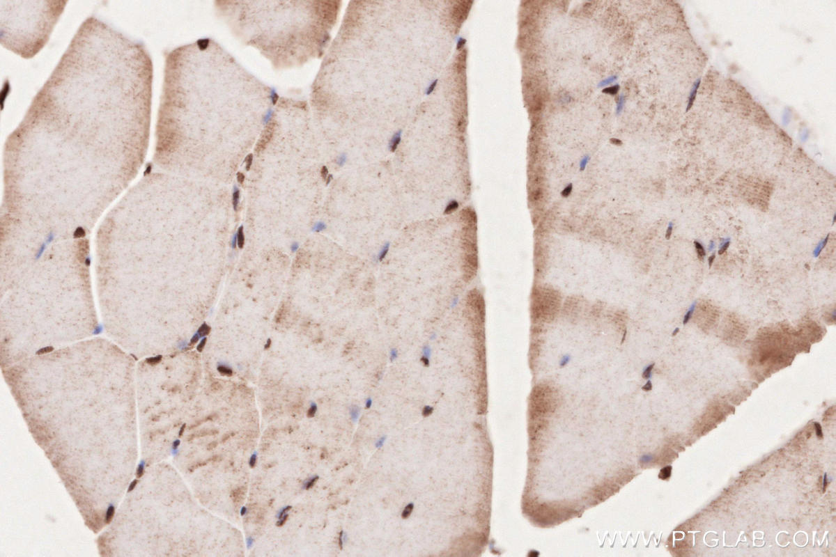 Immunohistochemical analysis of paraffin-embedded mouse skeletal muscle tissue slide using KHC2632 (MYPN IHC Kit).