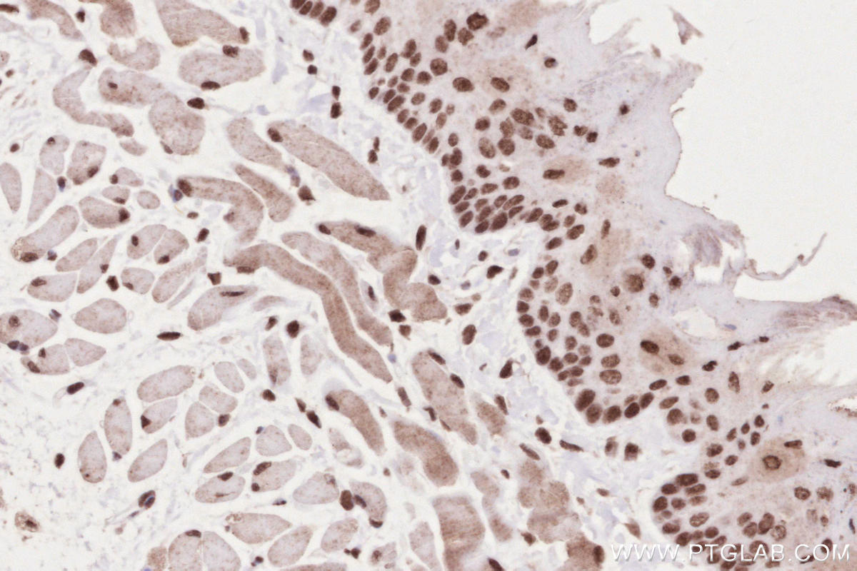 Immunohistochemical analysis of paraffin-embedded mouse tongue tissue slide using KHC2632 (MYPN IHC Kit).