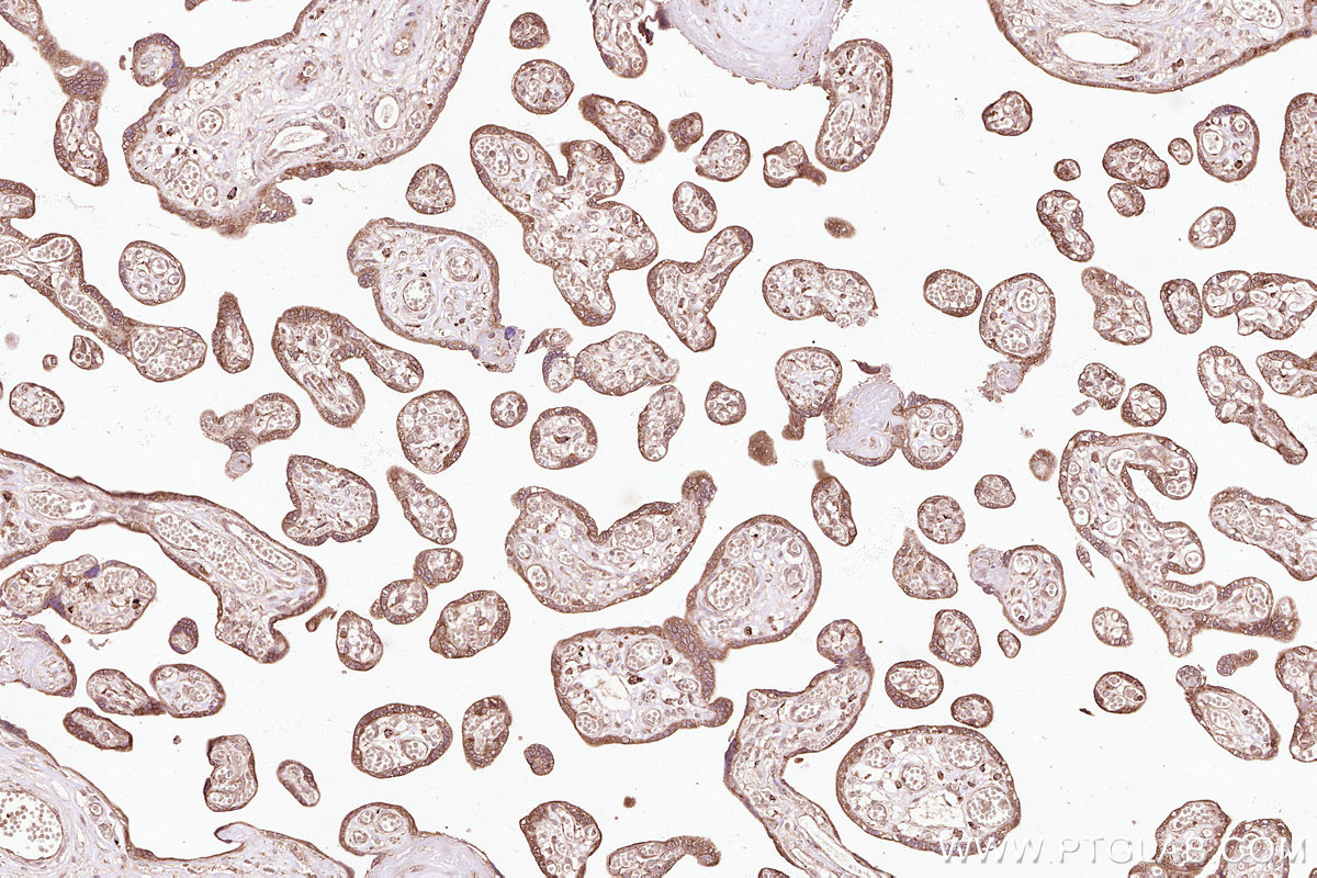 Immunohistochemical analysis of paraffin-embedded human placenta tissue slide using KHC3098 (NACA IHC Kit).