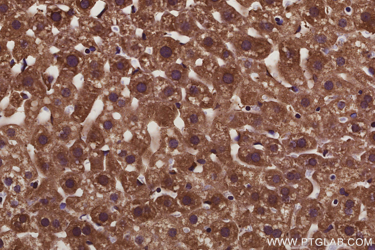 Immunohistochemical analysis of paraffin-embedded mouse liver tissue slide using KHC3098 (NACA IHC Kit).