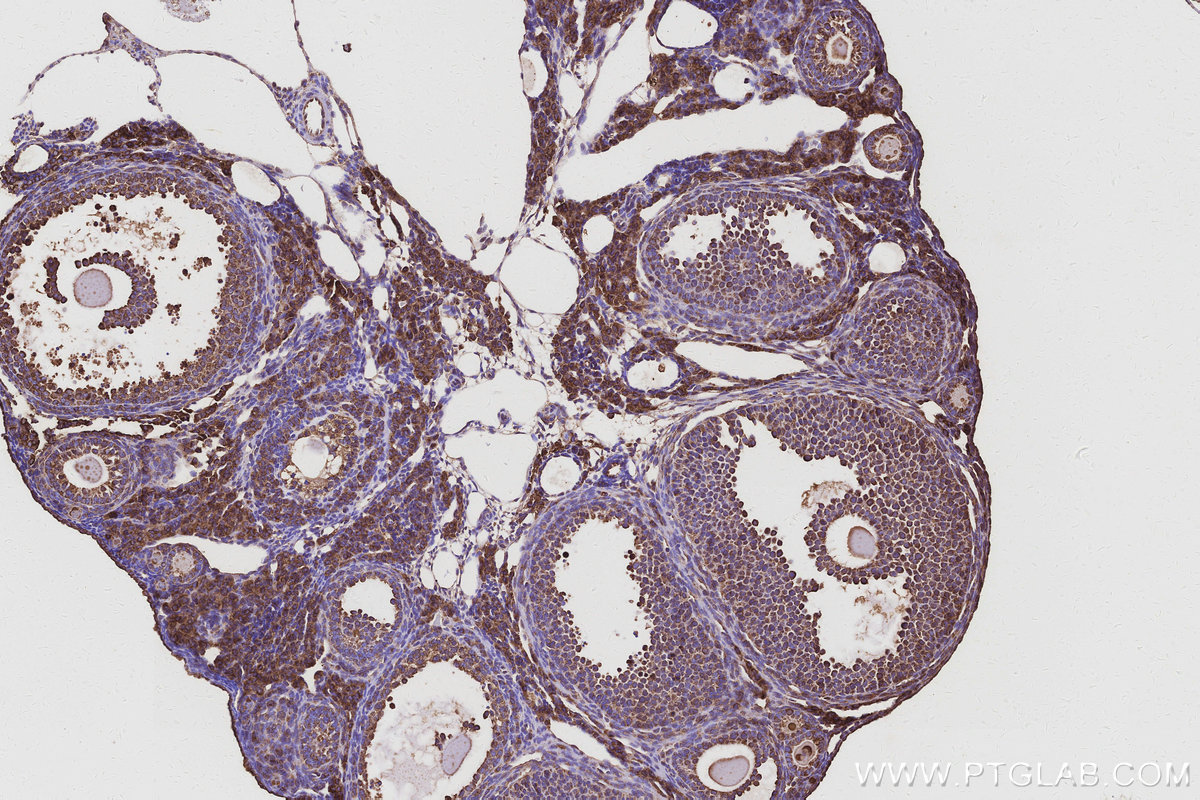 Immunohistochemical analysis of paraffin-embedded mouse ovary tissue slide using KHC3098 (NACA IHC Kit).