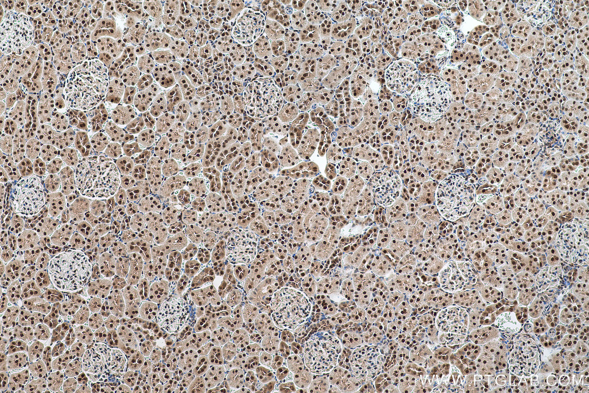 Immunohistochemical analysis of paraffin-embedded rat kidney tissue slide using KHC0644 (NAMPT/PBEF IHC Kit).