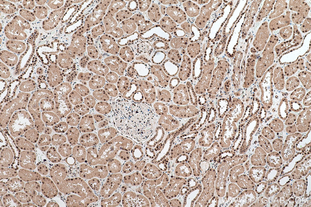 Immunohistochemical analysis of paraffin-embedded human kidney tissue slide using KHC0644 (NAMPT/PBEF IHC Kit).