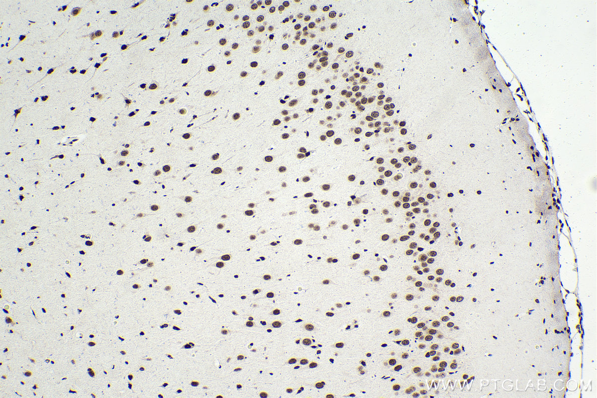 Immunohistochemical analysis of paraffin-embedded rat brain tissue slide using KHC1621 (NCBP2 IHC Kit).