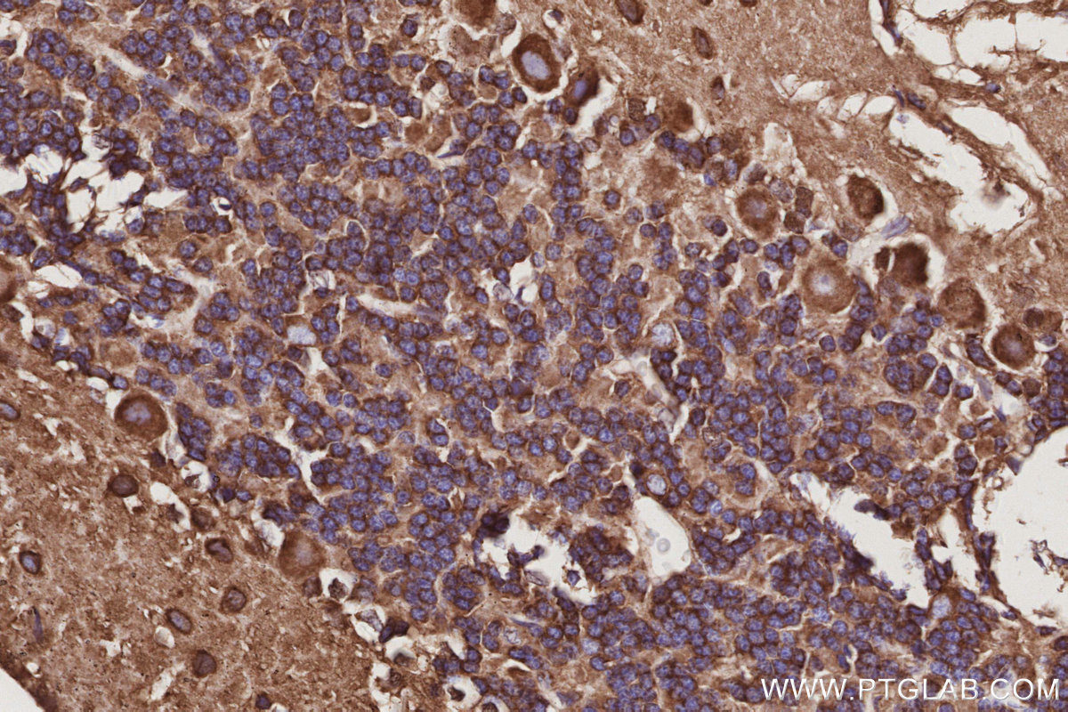Immunohistochemical analysis of paraffin-embedded rat cerebellum tissue slide using KHC3053 (NCKAP1 IHC Kit). Immunohistochemical analysis of paraffin-embedded rat cerebellum tissue slide using KHC3053 (NCKAP1 IHC Kit).
