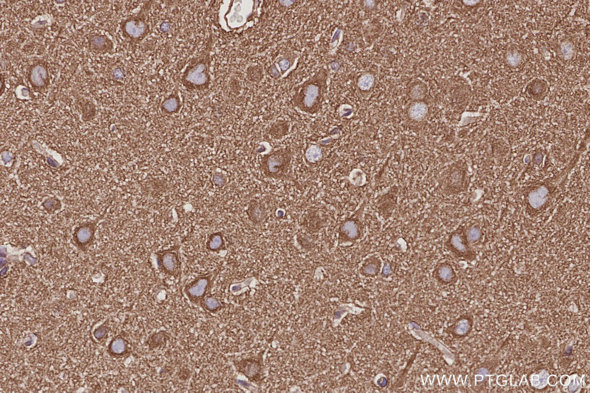 Immunohistochemical analysis of paraffin-embedded rat brain tissue slide using KHC3053 (NCKAP1 IHC Kit). Immunohistochemical analysis of paraffin-embedded rat brain tissue slide using KHC3053 (NCKAP1 IHC Kit).