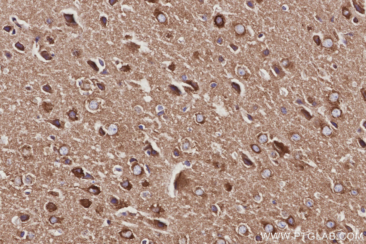 Immunohistochemical analysis of paraffin-embedded mouse brain tissue slide using KHC3053 (NCKAP1 IHC Kit). Immunohistochemical analysis of paraffin-embedded mouse brain tissue slide using KHC3053 (NCKAP1 IHC Kit).
