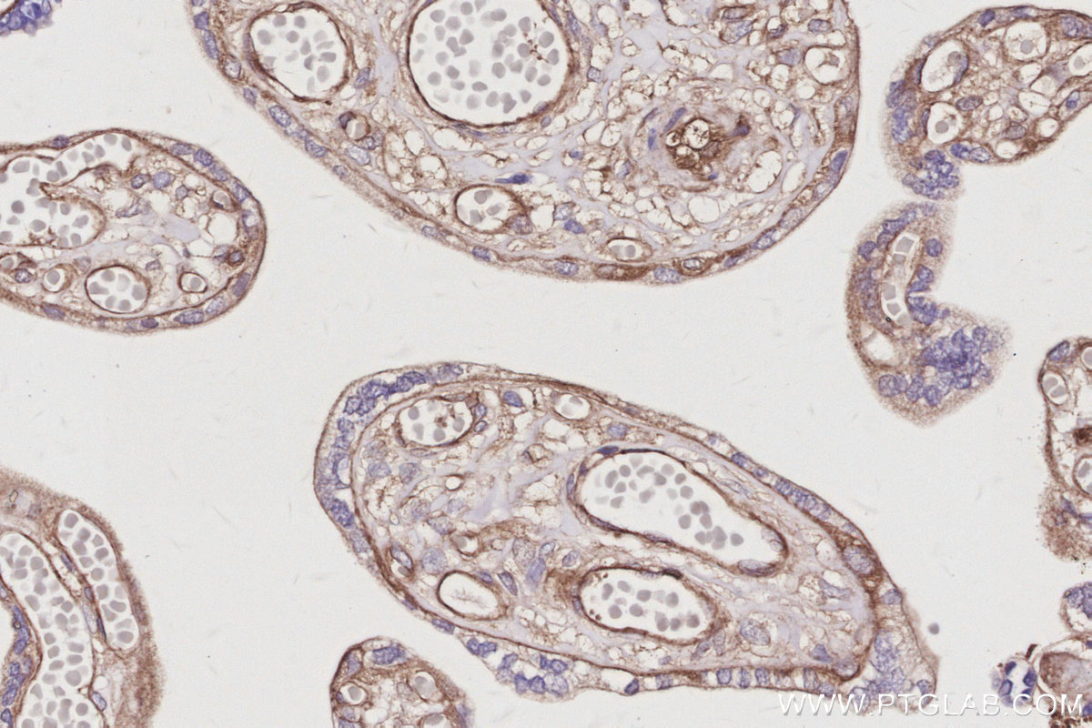 Immunohistochemical analysis of paraffin-embedded human placenta tissue slide using KHC3053 (NCKAP1 IHC Kit). Immunohistochemical analysis of paraffin-embedded human placenta tissue slide using KHC3053 (NCKAP1 IHC Kit).