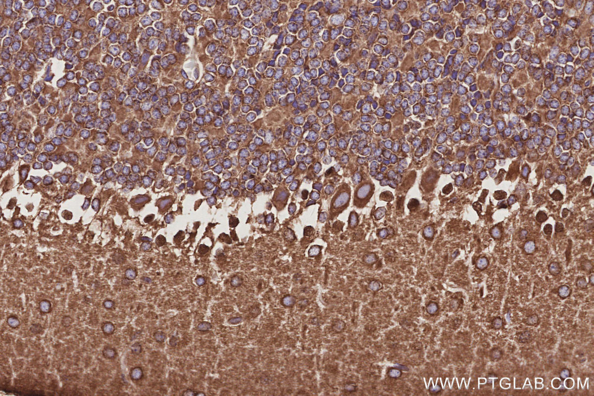 Immunohistochemical analysis of paraffin-embedded mouse cerebellum tissue slide using KHC3053 (NCKAP1 IHC Kit). Immunohistochemical analysis of paraffin-embedded mouse cerebellum tissue slide using KHC3053 (NCKAP1 IHC Kit).