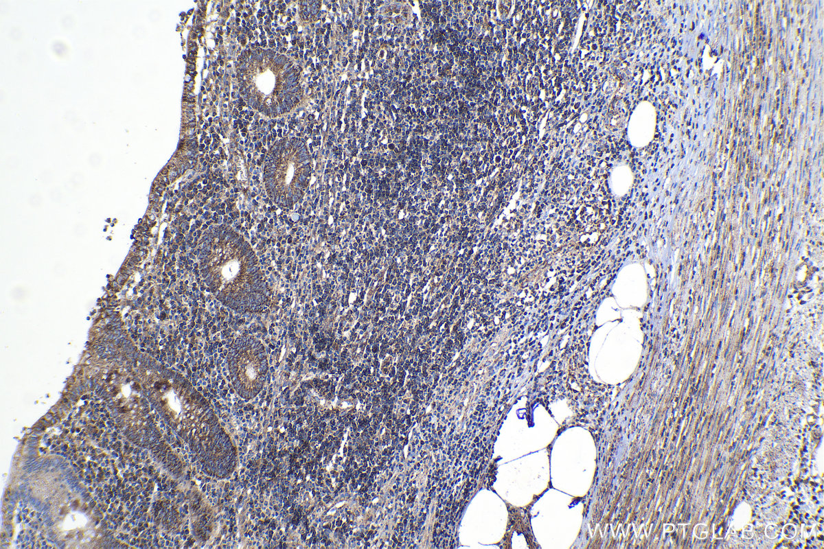 Immunohistochemical analysis of paraffin-embedded human appendicitis tissue slide using KHC1140 (NCKAP1L IHC Kit).