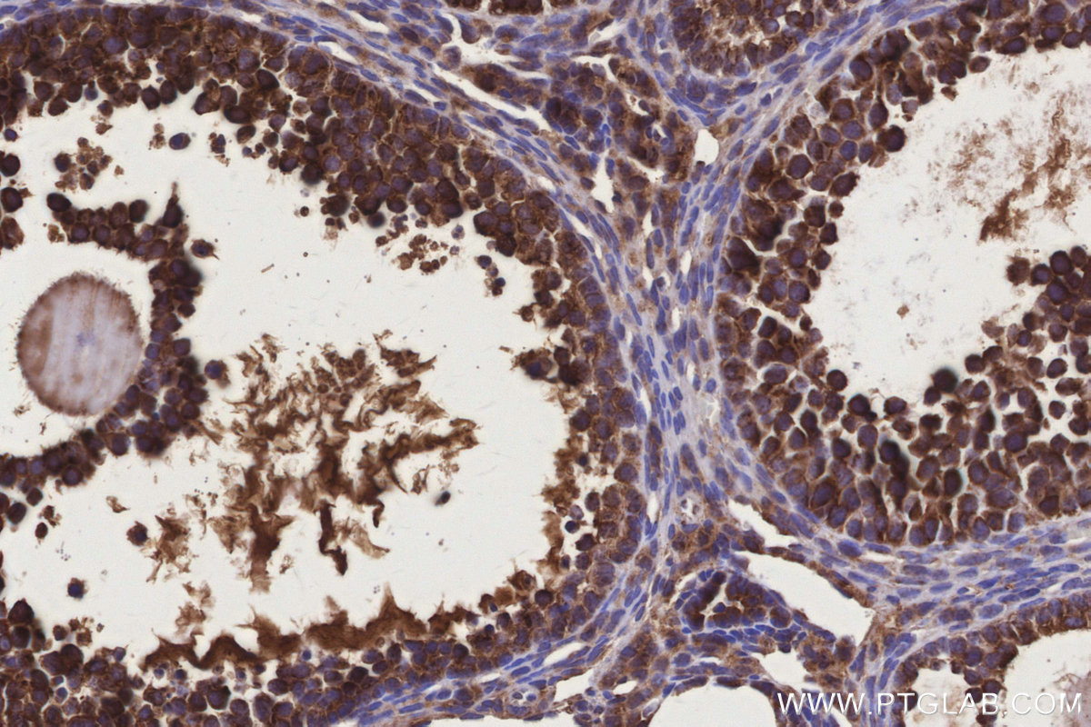 Immunohistochemical analysis of paraffin-embedded mouse ovary tissue slide using KHC3164 (ND4 IHC Kit).