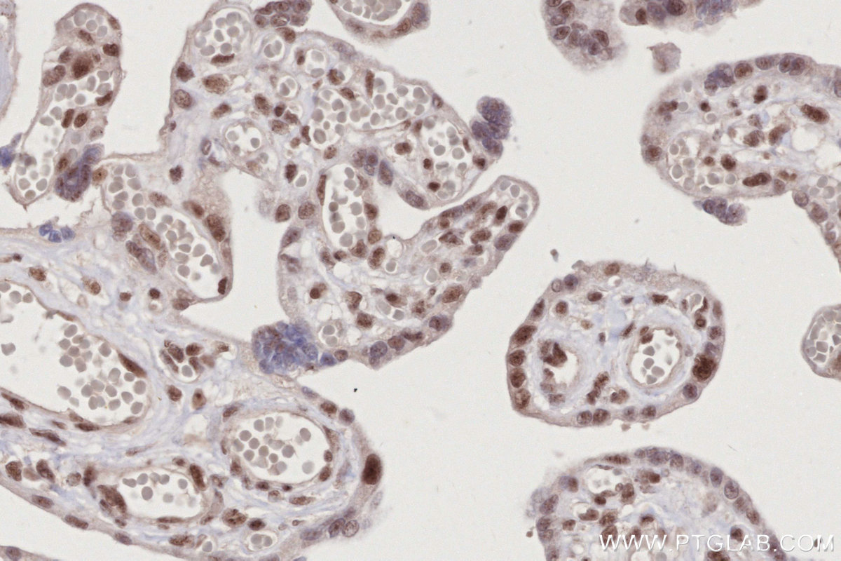 Immunohistochemical analysis of paraffin-embedded human placenta tissue slide using KHC2836 (NDNL2 IHC Kit).