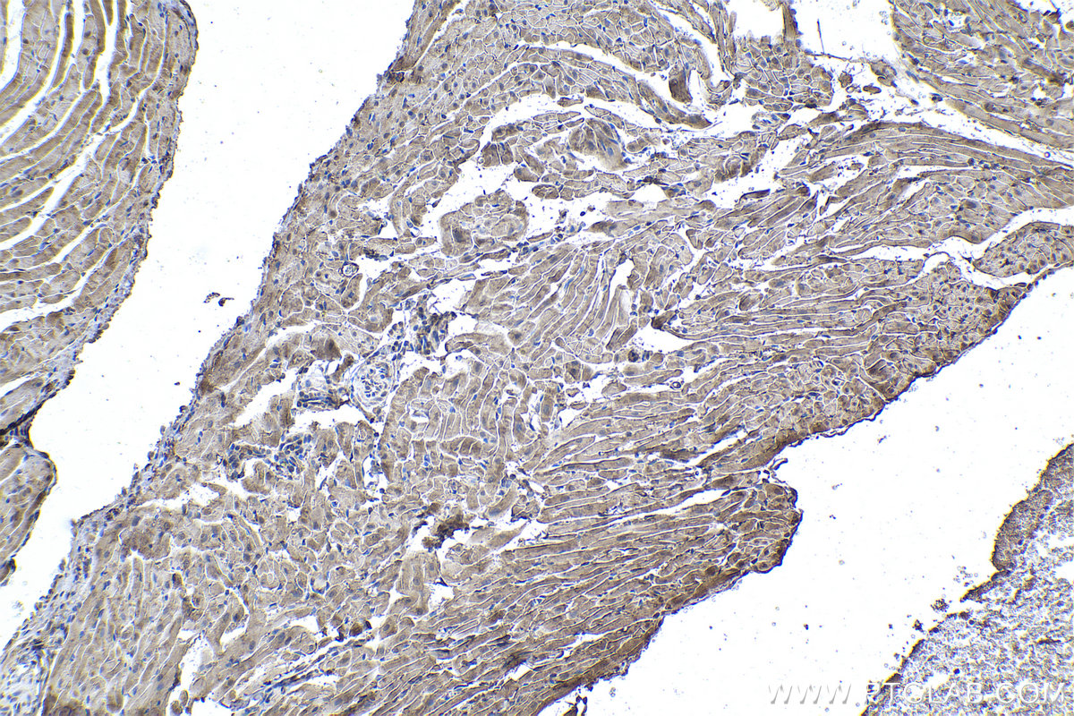 Immunohistochemical analysis of paraffin-embedded rat heart tissue slide using KHC1010 (NDRG2 IHC Kit).