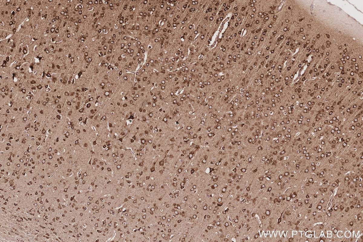 Immunohistochemical analysis of paraffin-embedded rat brain tissue slide using KHC3037 (NDRG4 IHC Kit).