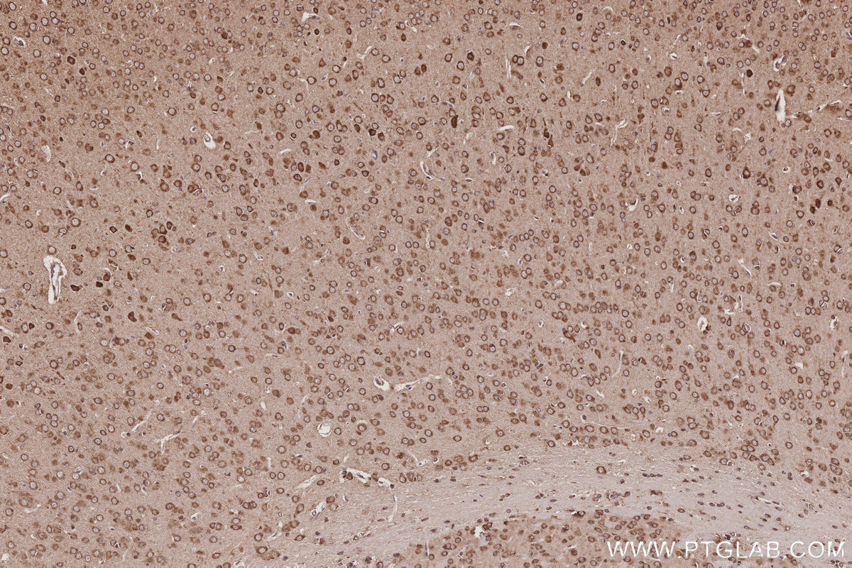 Immunohistochemical analysis of paraffin-embedded mouse brain tissue slide using KHC3037 (NDRG4 IHC Kit).