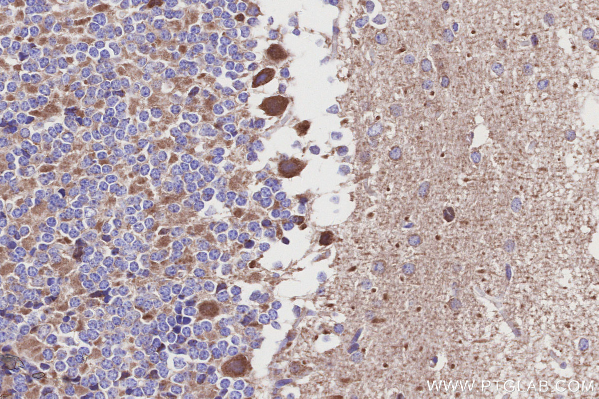 Immunohistochemical analysis of paraffin-embedded mouse cerebellum tissue slide using KHC3155 (NDUFA10 IHC Kit). Immunohistochemical analysis of paraffin-embedded mouse cerebellum tissue slide using KHC3155 (NDUFA10 IHC Kit).
