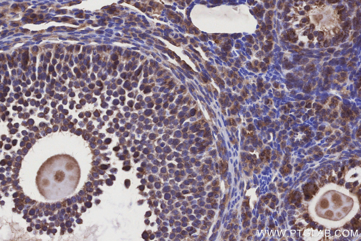 Immunohistochemical analysis of paraffin-embedded mouse ovary tissue slide using KHC3155 (NDUFA10 IHC Kit). Immunohistochemical analysis of paraffin-embedded mouse ovary tissue slide using KHC3155 (NDUFA10 IHC Kit).