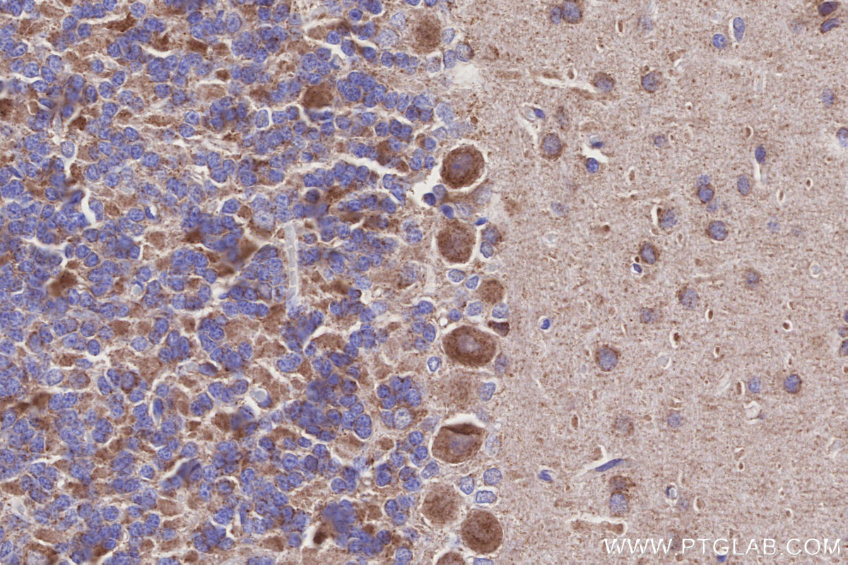 Immunohistochemical analysis of paraffin-embedded rat cerebellum tissue slide using KHC3155 (NDUFA10 IHC Kit). Immunohistochemical analysis of paraffin-embedded rat cerebellum tissue slide using KHC3155 (NDUFA10 IHC Kit).