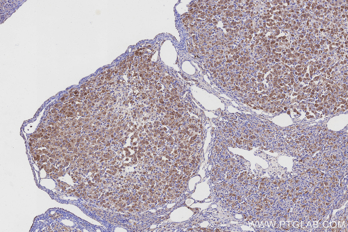 Immunohistochemical analysis of paraffin-embedded rat ovary tissue slide using KHC3155 (NDUFA10 IHC Kit). Immunohistochemical analysis of paraffin-embedded rat ovary tissue slide using KHC3155 (NDUFA10 IHC Kit).