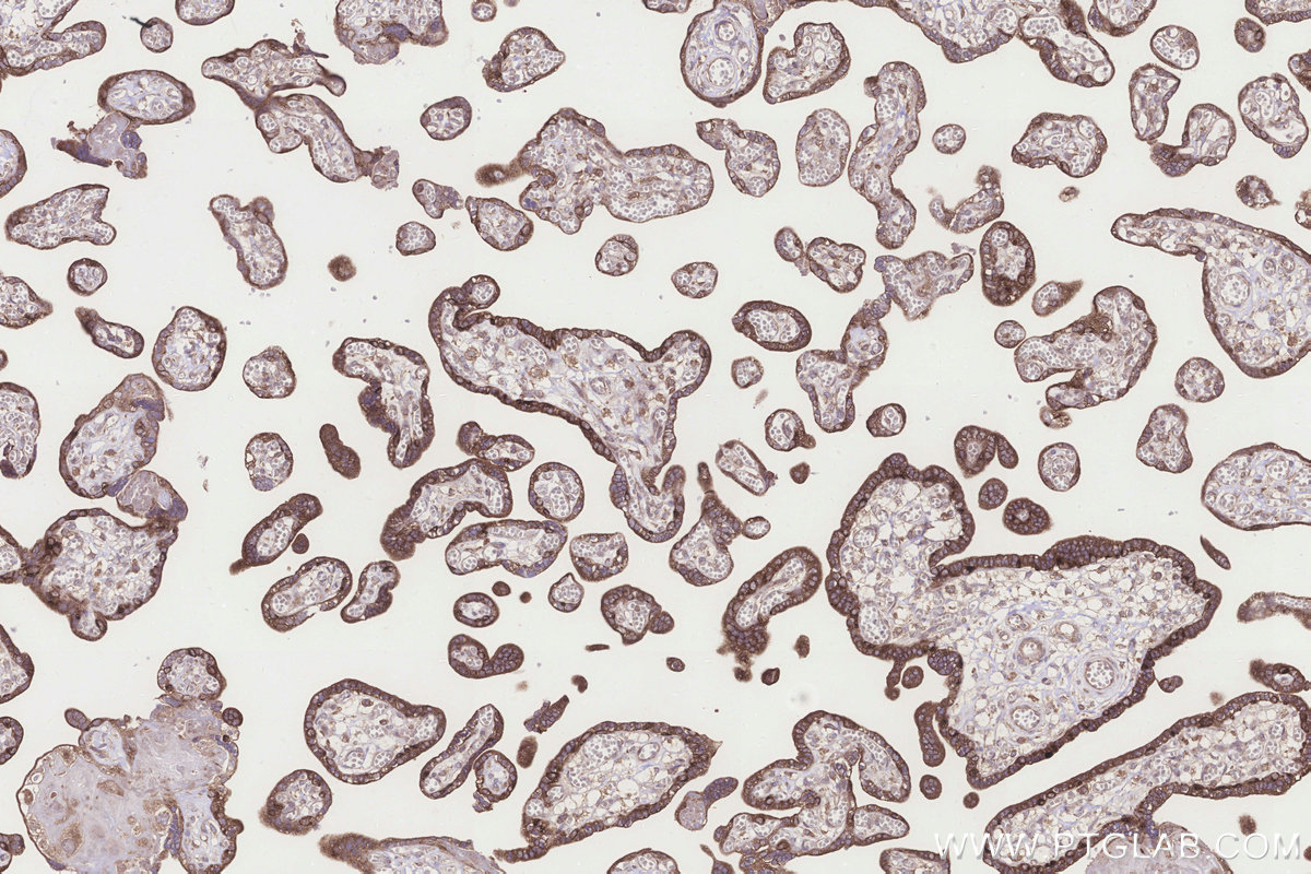 Immunohistochemical analysis of paraffin-embedded human placenta tissue slide using KHC3285 (NDUFA11 IHC Kit).