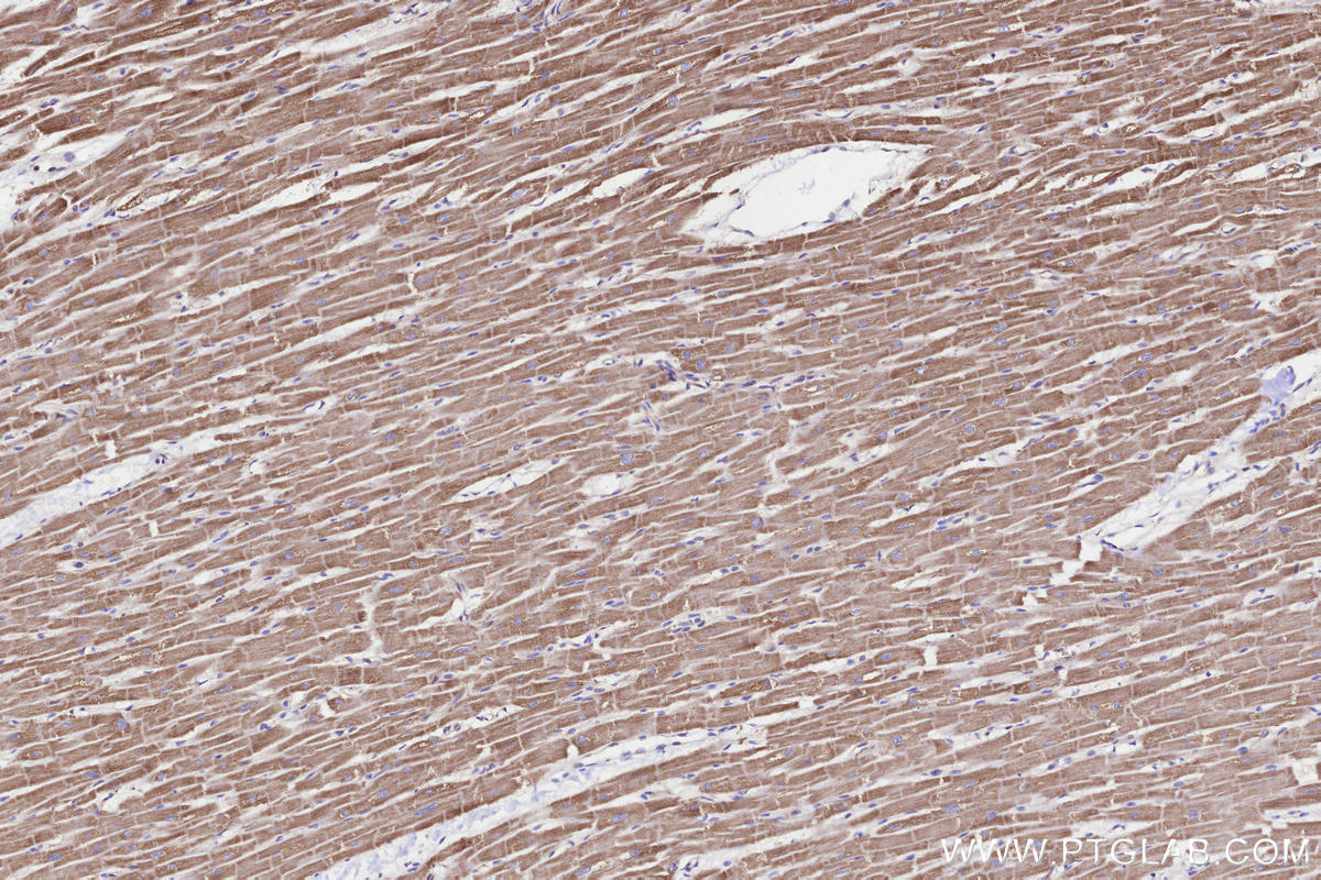 Immunohistochemical analysis of paraffin-embedded human heart tissue slide using KHC3285 (NDUFA11 IHC Kit).
