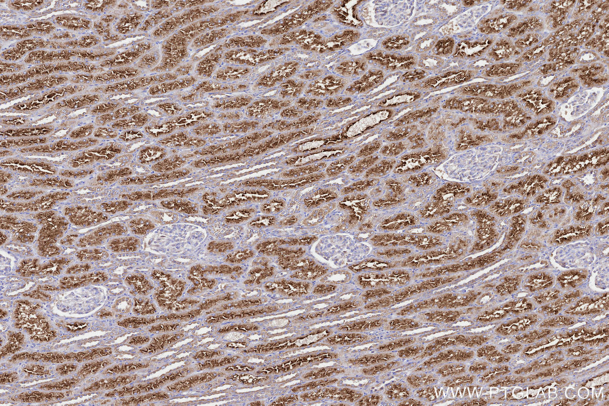 Immunohistochemical analysis of paraffin-embedded human kidney tissue slide using KHC3285 (NDUFA11 IHC Kit).