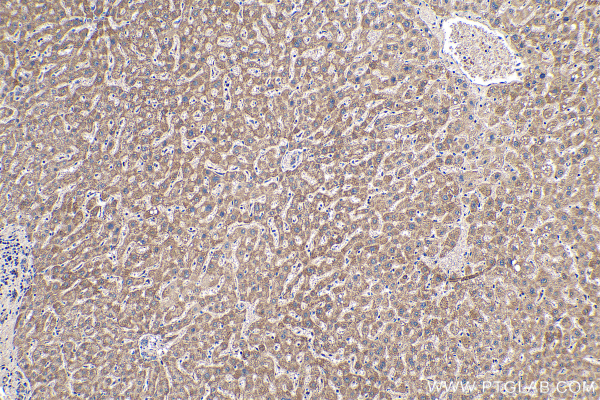 Immunohistochemical analysis of paraffin-embedded human liver tissue slide using KHC0246 (NDUFA13 IHC Kit).