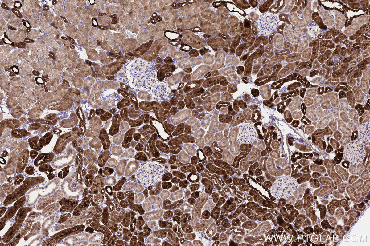 Immunohistochemical analysis of paraffin-embedded rat kidney tissue slide using KHC3225 (NDUFA8 IHC Kit).