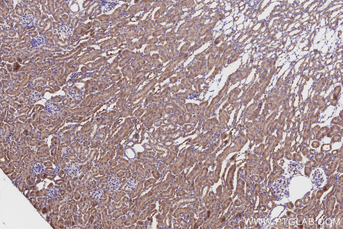 Immunohistochemical analysis of paraffin-embedded mouse kidney tissue slide using KHC3225 (NDUFA8 IHC Kit).