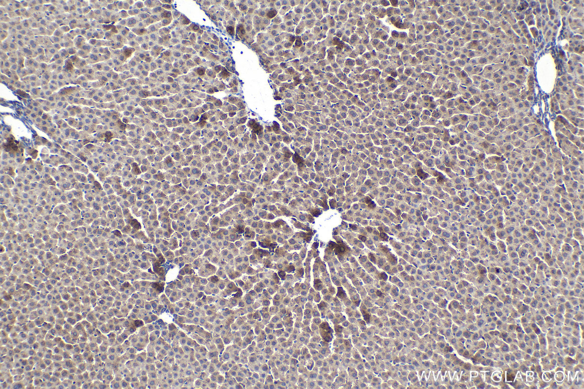 Immunohistochemical analysis of paraffin-embedded rat liver tissue slide using KHC1397 (NDUFAF1 IHC Kit).