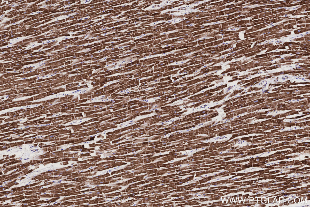 Immunohistochemical analysis of paraffin-embedded human heart tissue slide using KHC3158 (NDUFB10 IHC Kit).