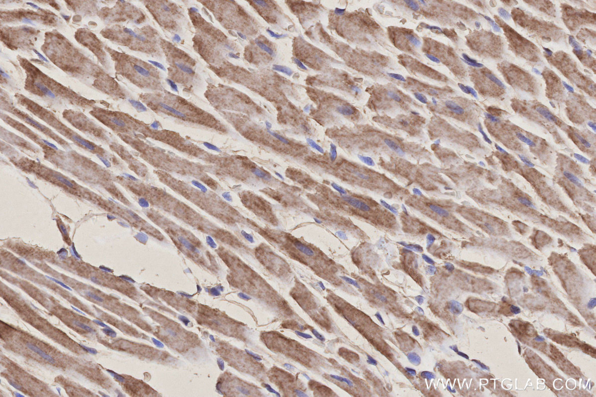 Immunohistochemical analysis of paraffin-embedded rat heart tissue slide using KHC3158 (NDUFB10 IHC Kit).