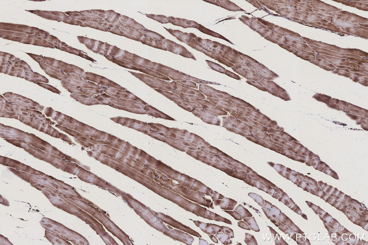 Immunohistochemical analysis of paraffin-embedded mouse skeletal muscle tissue slide using KHC3144 (NDUFB5 IHC Kit).