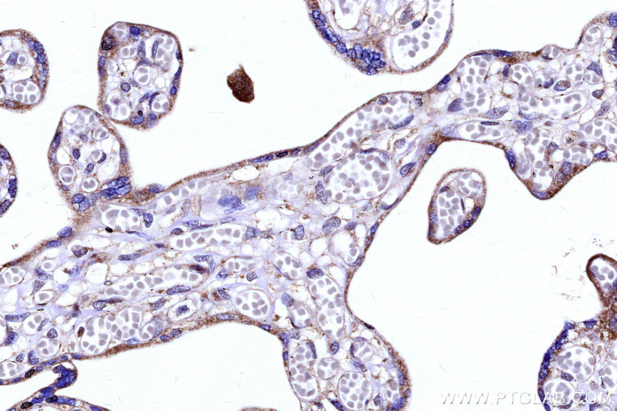 Immunohistochemical analysis of paraffin-embedded human placenta tissue slide using KHC3144 (NDUFB5 IHC Kit).