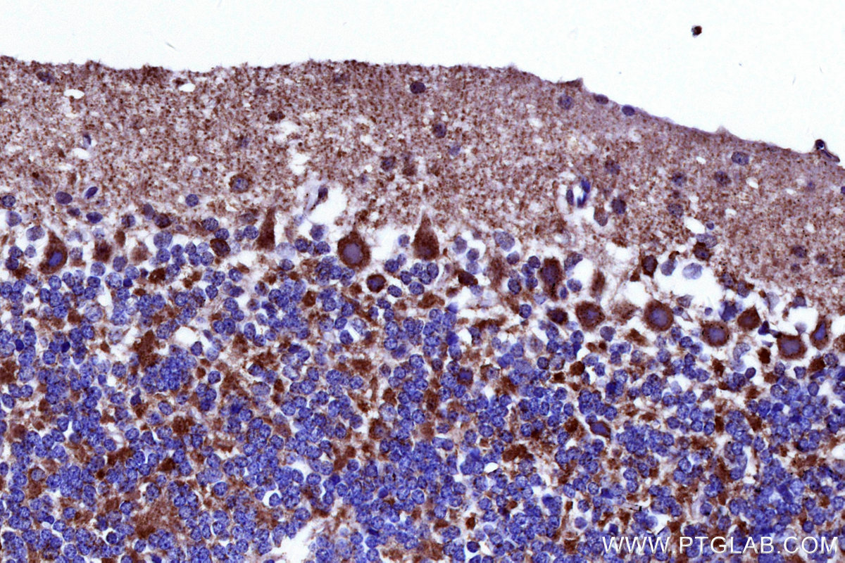 Immunohistochemical analysis of paraffin-embedded mouse cerebellum tissue slide using KHC3144 (NDUFB5 IHC Kit).