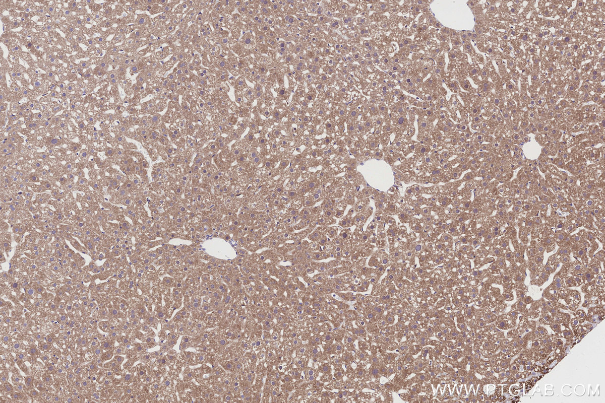 Immunohistochemical analysis of paraffin-embedded mouse liver tissue slide using KHC3193 (NDUFB7 IHC Kit).