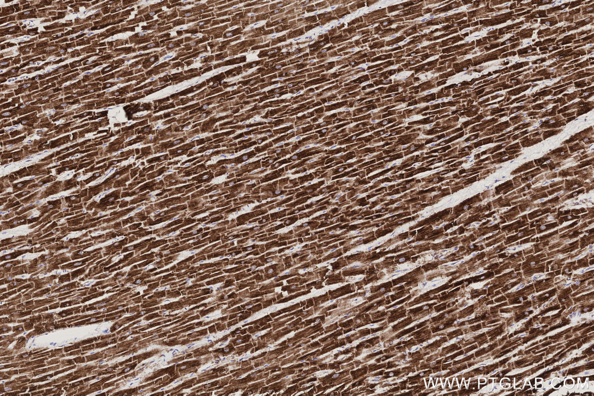 Immunohistochemical analysis of paraffin-embedded human heart tissue slide using KHC3193 (NDUFB7 IHC Kit).