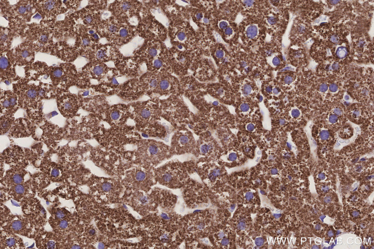 Immunohistochemical analysis of paraffin-embedded mouse liver tissue slide using KHC3242 (NDUFS1 IHC Kit).